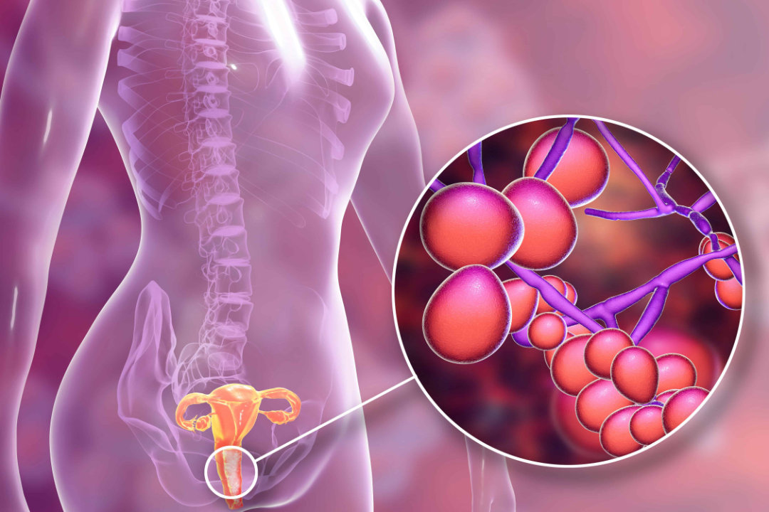 Dra. Silvia Villagrán, Ginecología, Control Ginecológico, Anticoncepción, Climaterio Y Post Menopausia, Control Mamario, Detección De Cáncer Cervical, Ginecoestética, Labioplastía De Reducción, Labioplastia De Aumento, Rejuvenecimiento Con Radiofrecuencia, Aumento Del Punto G, Rejuvenecimiento Vaginal, Atrofia O Resequedad Vulvovaginal, Vaginoplastia, Incontinencia De Esfuerzo, Colposcopía, Patología Vulvar, Obstetricia, Control Prenatal, Quito, Ecuador, www.doctorasilviavillagran.com